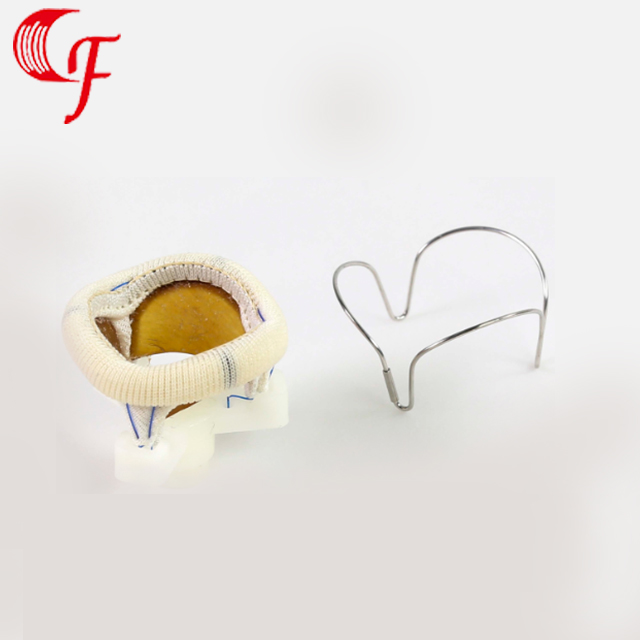 无锡心脏瓣膜瓣架（Heart valve frame）